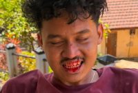 ​Ketua DPC GMNI Jember.